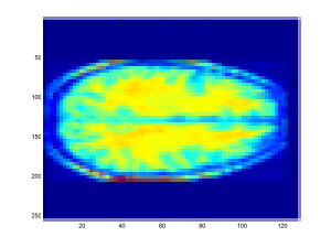 Downsampled Image (Zoomed-In)