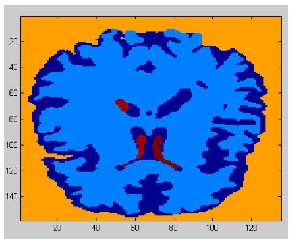 Slice of segmented 3d MRI data.